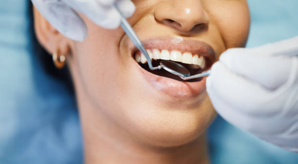 Best Emergency Tooth Extraction in Chalfont, PA